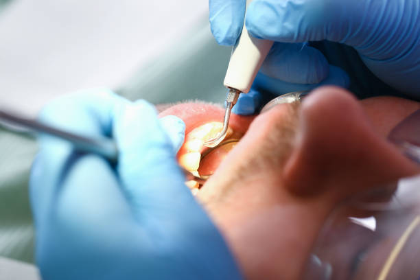 Best Emergency Denture Repair in Oolitic, IN
